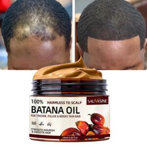 كريم باتانا النادر للتساقط